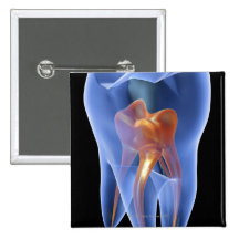 Dent, section transversale transparente d'une mola badges avec agrafe