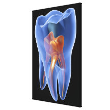 Dent, section transversale transparente d'une mola toiles tendues