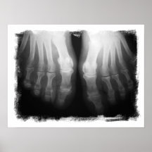 Noir animal et blanc squelettiques humains de pied posters