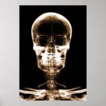 RÖNTGENBLICK-SKELETON SCHÄDEL - ORANGE POSTERDRUCKE