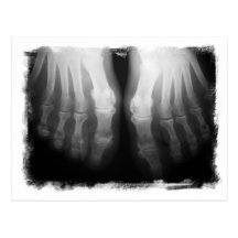 Röntgenstrahl-Fuß-menschliches Skeleton Knochen-Sc Postkarte