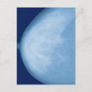 Recherche de rayons x cartes postales Partie du corps humain