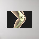 Suche nach knies poster Patella