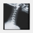 Suche nach röntgenbild magnete Teil