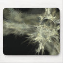 Suche nach apophysis Apophyse