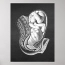 Suche nach doula poster Für sie