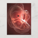 Recherche de développement cartes postales Vertical