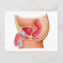 Recherche de urinaire posters Coccyx