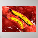 Suche nach kardiovaskulär poster Illustration