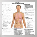 Suche nach bakteriell poster Diagramm