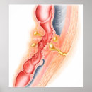 Suche nach entwicklung poster Biomedizinische illustrationen