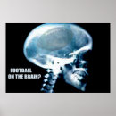 Suche nach röntgen poster Schädel