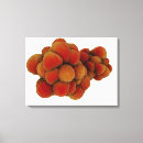 Recherche de tumeur posters Pathologie