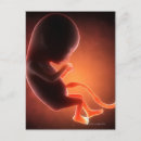 Recherche de foetus cartes postales Médical