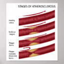Recherche de cardio posters Crise cardiaque