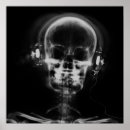 Recherche de xray posters Personnalisés