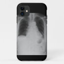 Recherche de chirurgie iphone coques Récupération