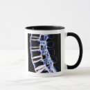 Recherche de vertèbre tasses Médical