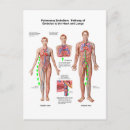 Recherche de cage thoracique cartes postales Anatomie