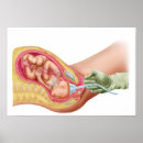 Suche nach reproduktive organe poster Medizin