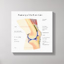 Suche nach orthopädie kunst Knochen