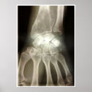 Suche nach röntgen kunst Radiologie