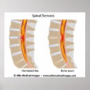 Suche nach spinal poster Anatomie