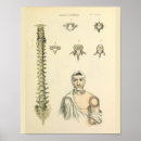 Recherche de colonne vertebrale art Imprimer
