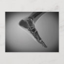 Suche nach menschlicher fuß poster postkarten Gesundheit