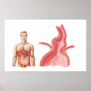 Suche nach menschlicher magen poster Torso