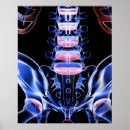 Recherche de rayons x posters Médical