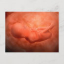 Suche nach embryo postkarten Menschliche fruchtbarkeit