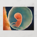 Suche nach embryo postkarten Schwanger
