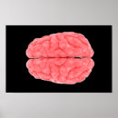 Recherche de lobes posters Neurologie