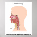 Suche nach chirurgie poster Operation