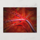 Recherche de globules rouges cartes postales Médecine