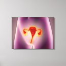 Suche nach weibliche anatomie leinwandbilder Innere organe