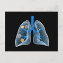 Recherche de cavité posters Santé