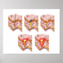 Suche nach entzündung poster Biomedizinische illustrationen