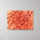 Suche nach bakterien leinwandbilder Detail