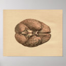 Recherche de lobes posters Anatomie