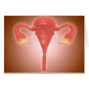 Suche nach menschliche organe Gebärmutter