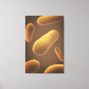 Recherche de pathologie art Répétition