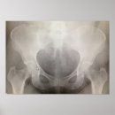 Suche nach pelvis poster Knochen