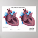 Suche nach kardiovaskulär poster Kardiologie
