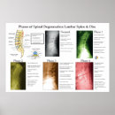 Suche nach chiropraktik poster Wirbelsäule