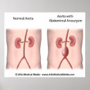 Recherche de circulatoire posters Abdomen