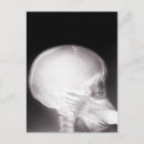 Suche nach x ray postkarten Radiologie