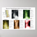 Suche nach chiropraktik poster Wirbelsäule