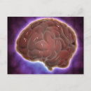 Suche nach gehirne postkarten Neurologie